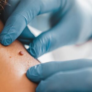 Lesões Cutâneas Elementares e Semiologia Dermatológica